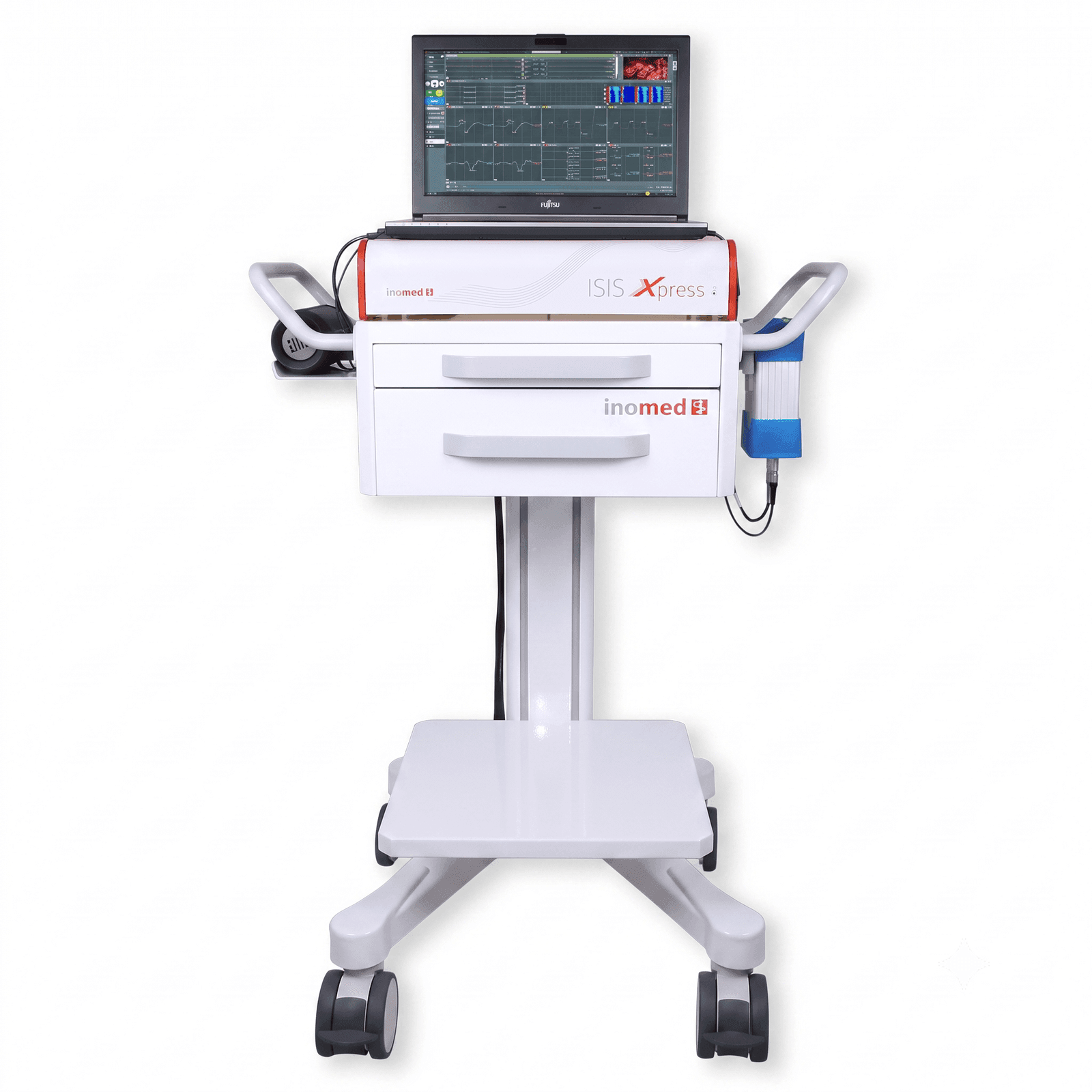 Equipos de Neuromonitoreo Intraoperatorio